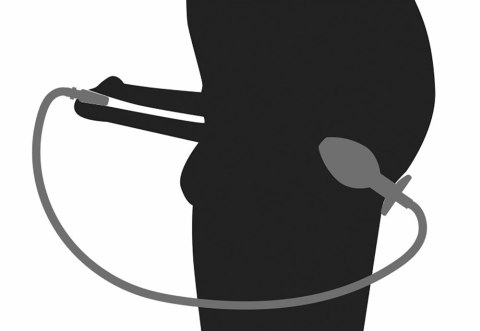Mystim Plug & Play - Zestaw intymny ze stali nierdzewnej i silikonową rurką Penisplug